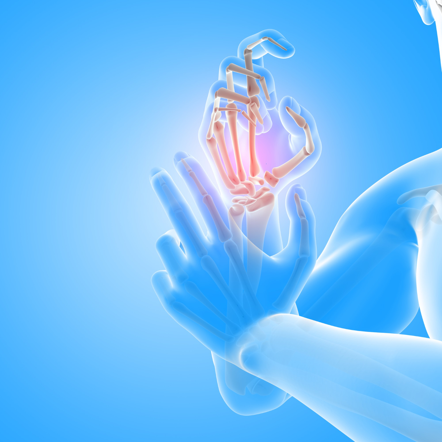 stem cell therapy for arthritis

