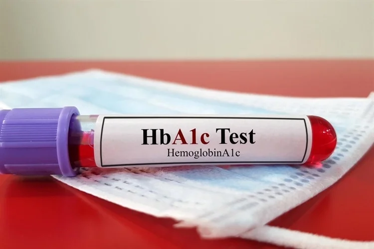 Diabetes Treatment in India, Diabetes Stem Cell Therapy